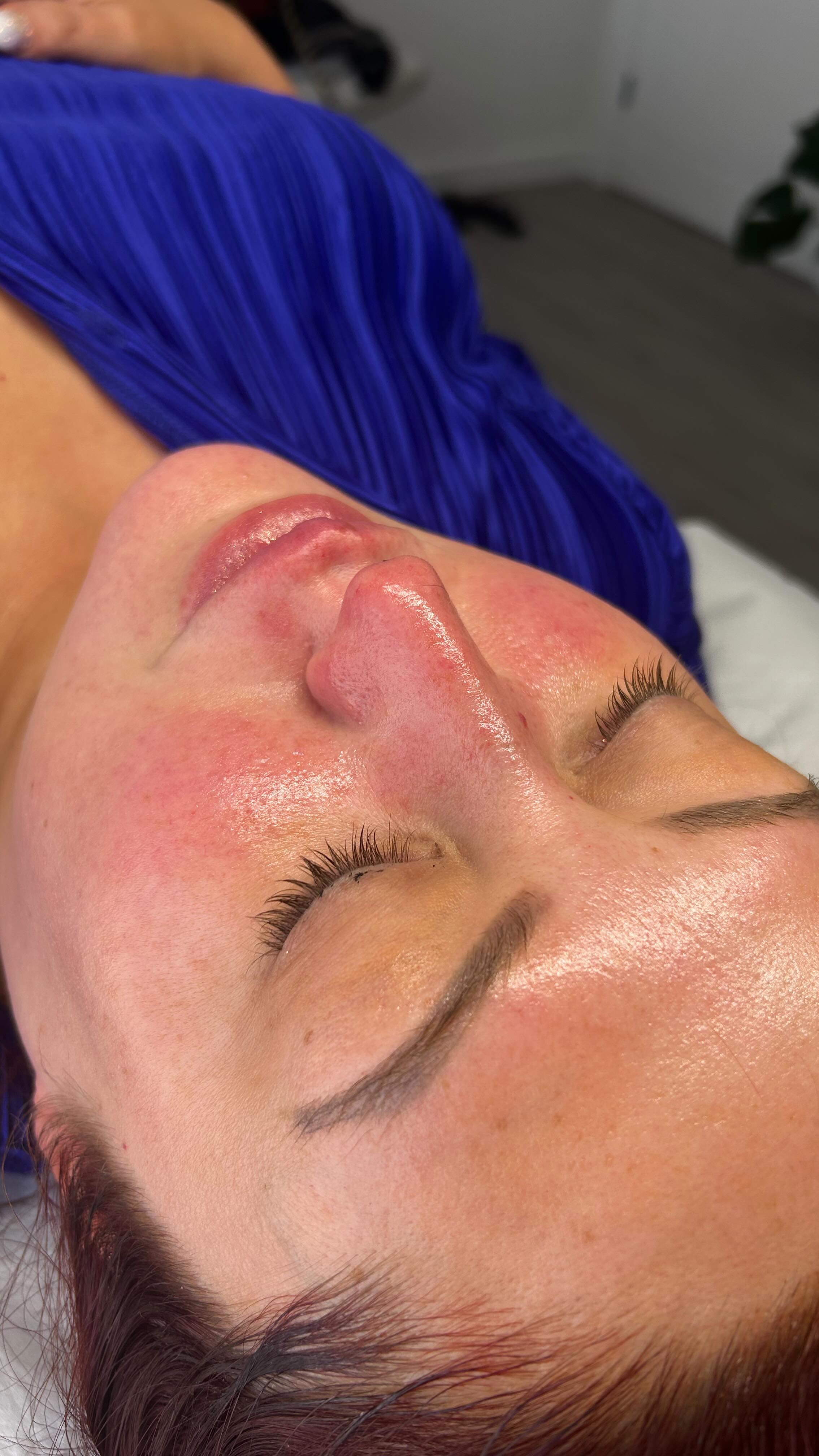 Fresh glowing skin after a ZLD Beauty facial